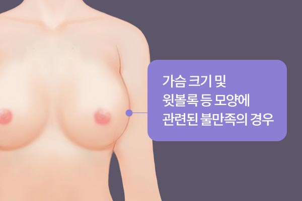 가슴 크기 및 윗볼록 등 모양에 관련된 불만족의 경우