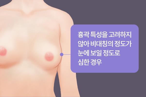 흉곽 특성을 고려하지 않아 비대칭의 정도가 눈에 보일 정도로 심한 경우